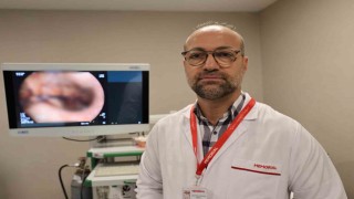 Mide küçültme tercihinde yeni yöntem ameliyatsız endoskopik tüp mide işlemi