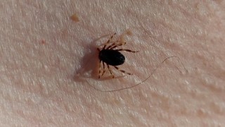 Prof. Dr. Gürdal Yılmaz: Bu yıl 21 KKKA vakası geldi bu hastalardan ikisi hayatını kaybetti