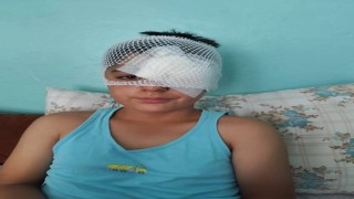 Şanlıurfada köpek saldırısından kaçan çocuğa otomobil çarptı