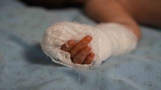 Serum kelebeğini çıkarmak isterken bebeğin parmağını kesti