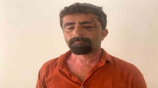 Antalyada öfkeli damat kayınpederini hastanelik etti