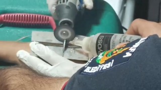 Çocuğun parmağına sıkıştırdığı cıvata pulu kesilerek çıkartıldı