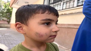 Evde uyuyan çocuğu lağım faresi ısırdı