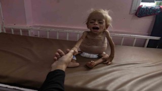 Gazzede 8 sivil daha açlık nedeniyle hayatını kaybetti