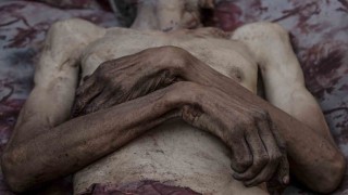 Gazze’de Açlık 6 Can Daha Aldı: Toplam 175 Ölüm