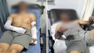 Manisada sanayi sitesinde patlama: 2 yaralı