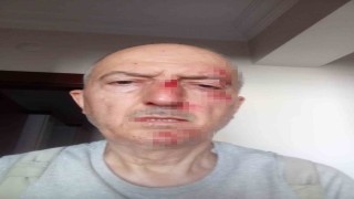 Önce icra yoluyla evinden tahliye edildi, ardından darp edildi