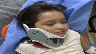 Orduda ters şeritten gelen scooter, 8 yaşındaki çocuğa çarptı