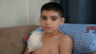 Vücudu köpek tarafından parçalanan Yunusun kolu kullanılamaz hale geldi, aile adalet arıyor