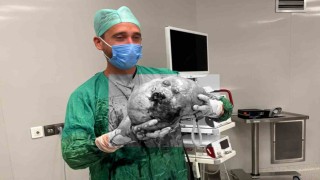 Yozgatta bir hastadan karpuz büyüklüğünde kitle çıkartıldı