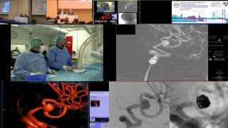 Canlı yayında zorlu beyin ameliyatı