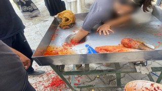 Kız çocuğu elini salça makinesine kaptırdı