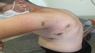 Kız kardeşini korumak isterken 5 yerinden bıçaklanmıştı: O anları anlattı: Ölümden döndüm