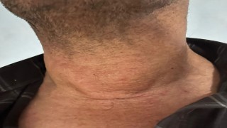 Kütahyada dev guatr ameliyatsız tedavi edildi: Yüzde 90dan fazla küçülme oldu