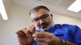 Özelde 8 bin TL olan kaplama, devlet hastanesinde 188 TLye yapılmaya başladı