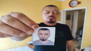 Saçlarını siyahlatmak için aldığı şampuan arı sokmasından beter hale getirdi