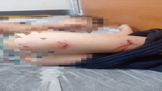 Sokak köpekleri faciaya neden oluyordu: Komşular yetişmeseydi parçalayacaklardı