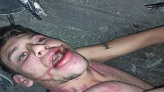 Antalyada Böcek yedirip dişlerimi kırdılar iddiasına 20 yıl hapis talebi