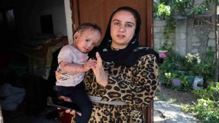 Balık pulu ve kelebek hastası Yusufun yardım paralarını dolandırıcılar topladı