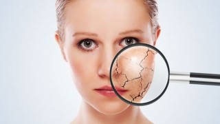 Cildiniz için kışa hazırlık reçetesi