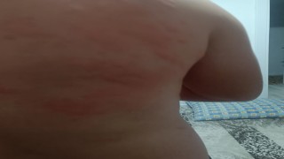 Elazığda böcek ısırığı hastanelik etti