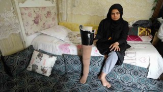 Kahramanmaraş merkezli büyük depremde bacağını kaybetti, eşi terk etti