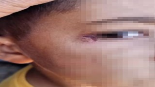 Öğrencinin yüzünde sigara söndüren temizlik görevlisi tutuklandı