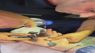 Parmağına yüzük sıkışan vatandaşın imdadına itfaiye ekipleri yetişti