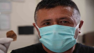 Protez gözü hayatını kabusa çevirdi