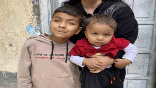 Tedaviyle dünyanın renklerini ilk defa gören 2 kardeş, başka hastalara da umut oldu