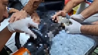 Tel Abyadta elini kıyma makinesine kaptıran çocuk Şanlıurfada tedavi altına alındı