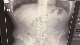 Uşakta midelerinden uyuşturucu çıktı: İranlı 3 kişi tutuklandı