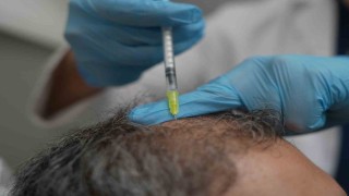 Dökülen saçlar vücudun bir alarmı olabilir