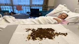 Hastadan çıkan taşları sayamadılar