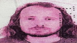 İngiliz vatandaşı, Türkiyede saç ekimi ve diş tedavisi ardından hayatını kaybetti