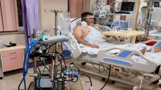 Kalp ameliyatında ECMO başarısı, bir ilk oldu