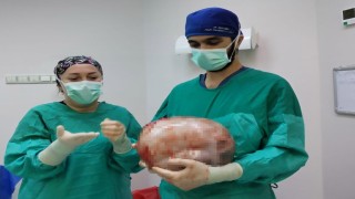 Karnı 2 ayda 9 aylık hamile gibi büyüyen kadının içinden karpuz kadar kitle çıkarıldı