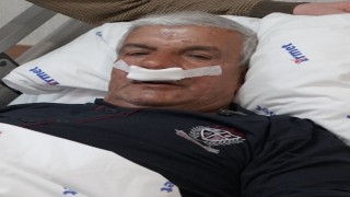 65 yaşındaki adamın burnundan 100 gramlık taş çıkarıldı