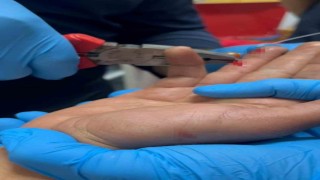 Balık macerası hastanede bitti: Parmağına saplanan olta iğnesini itfaiye çıkarttı