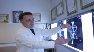 Boy kısalığına karşı modern çözüm: kemik uzatma yöntemleri