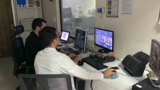 Gereksiz anjiyo dönemi bitiyor: Edirnede Stres Kardiyak MRI görüntüleme yöntemi uygulanmaya başlandı