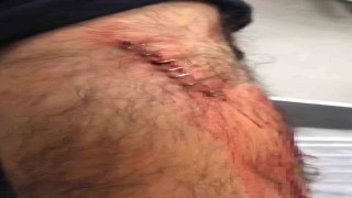 Şanlıurfada görev yapan öğretmene sokak ortasında jiletli saldırı