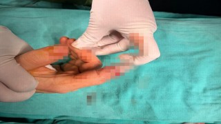 Bandırmada asansör kazasında kopan parmak başarılı ameliyatla kurtarıldı