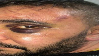 İsyeri sahibi dükkanında öldüresiye darp edildi