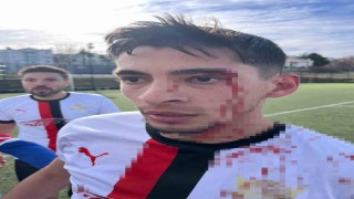 Maç sonrası saha içi savaş alanına döndü, 3 futbolcu hastanelik oldu