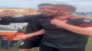 Maç sonu saha karıştı: 3 futbolcu yaralandı