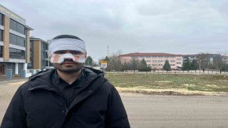 Rehber öğretmenin yüzüne sıcak çay fırlattığı fizik öğretmeni feci şekilde yandı