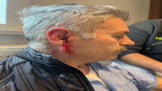Silivride özel bakım merkezine çağrılan eski çalışan darbedildi