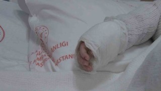 Üzerine kaynar su dökülen bebeğin vücudunun yüzde 27si yandı
