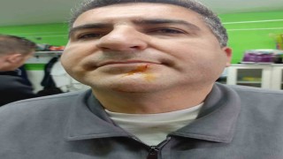 Zonguldakta 3. Lig maçı sonrası gerginlik: 2 gazeteci darbedildi, 2 polis yaralandı